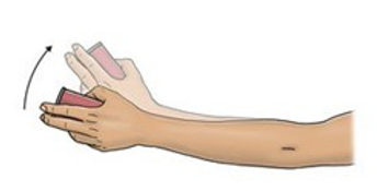 Wrist Radial Deviation