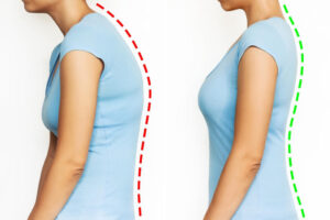 Physiotherapy for Posture Correction