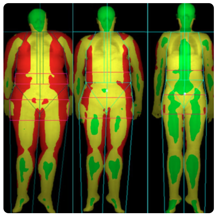 DEXA Image 3