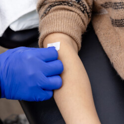 bandage to patient after acupuncture treatment